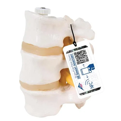 3 Human Lumbar Vertebrae, Flexibly Mounted – 3B Smart Anatomy – 1000151