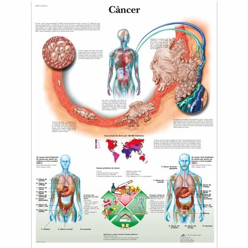 Câncer, 50×67 cm, Laminado – 1002197