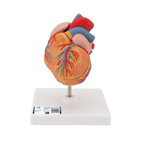 Classic Human Heart Model with Left Ventricular Hypertrophy (LVH), 2 part – 3B Smart Anatomy – 1000261
