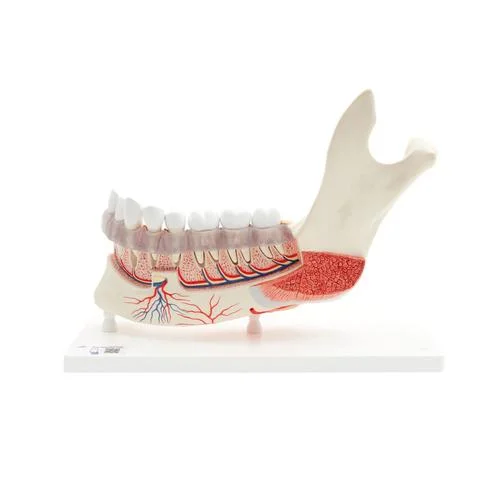 Comprehensive Lower Jaw Model (Left Half) with Diseased Teeth, Nerves, Vessels & Glands, 19 part – 3B Smart Anatomy – 1001250