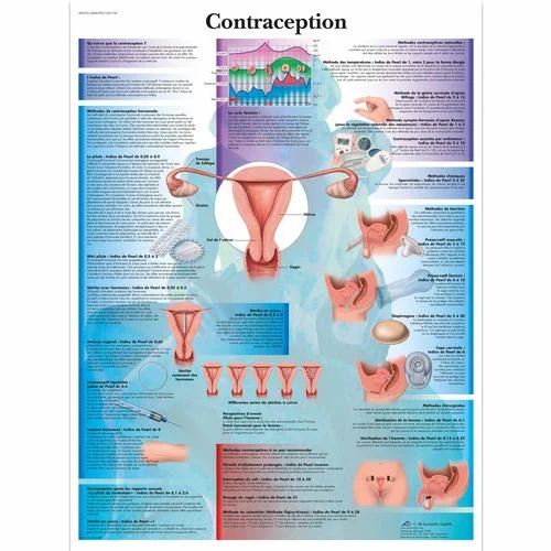 Contraception – 1001747