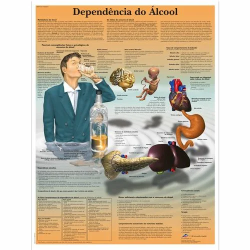 Dependência do alcool, 50×67 cm, Versao Papel – 4007016