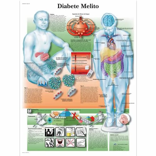 Diabete melito, 50×67 cm, Versao Papel – 4006999