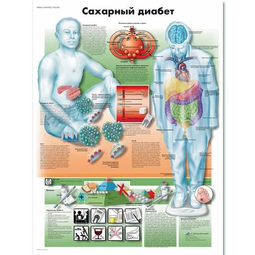 Diabetes mellitus Chart – 1002296