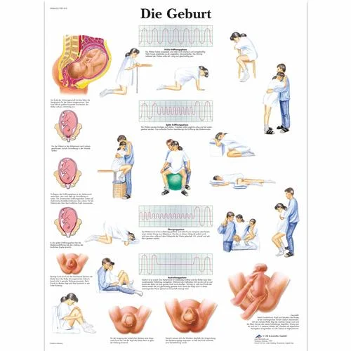 Die Geburt – 1001410
