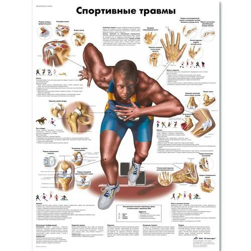 Sports Injuries Chart – 1002236
