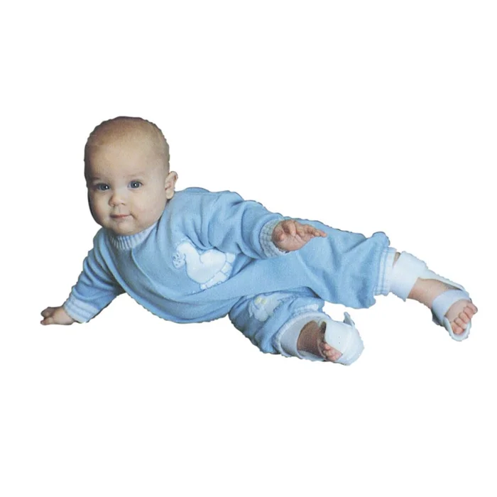 Wheaton CTEV Brace and Wheaton MTA Brace Wheaton Brace, MTA, 3-8 mo., Left – 6329/NA/LF